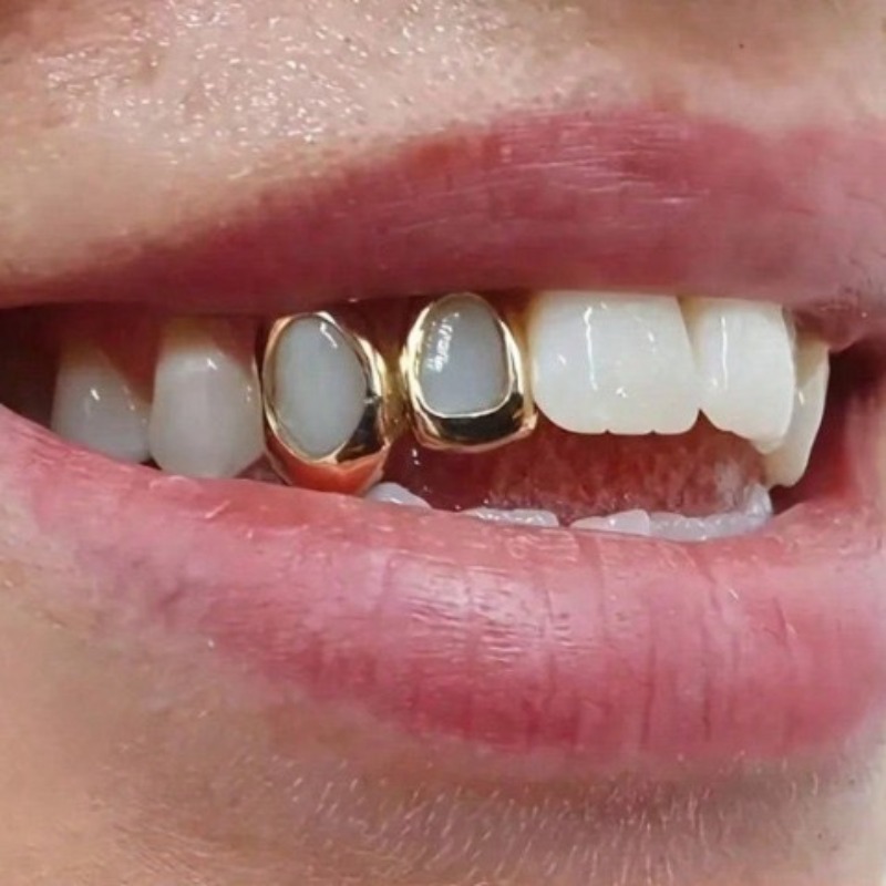 Set Perhiasan Gigi Golden Gril - Body Jewelry Changing Kit ulasan dan harga